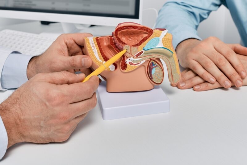 model anatomic al aparatului reproducator masculin consultatie urologie prostatita
