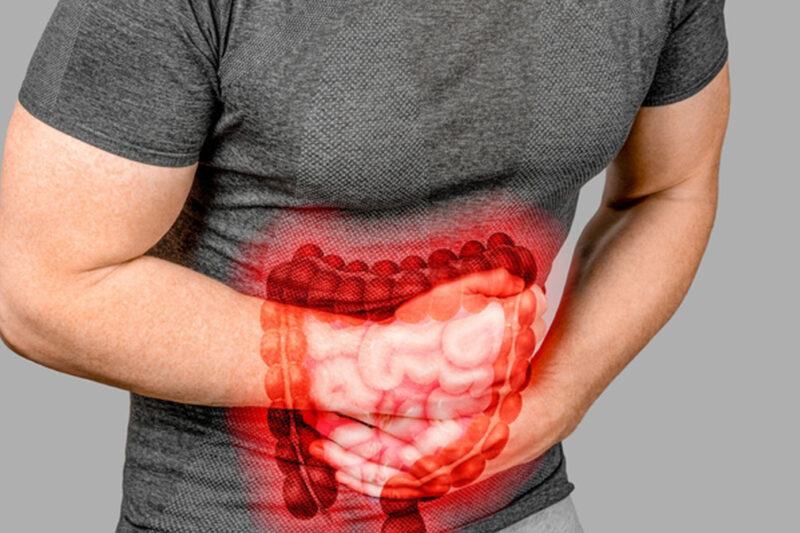 Imagine reprezentând un colon iritabil