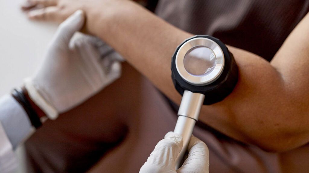 dermatoscop pentru diagnosticare prurit